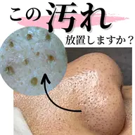 【4月限定】いちご鼻撃退！毛穴集中コース60分★モニター鼻のみ