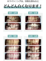 【ミニモ限定】メディアで話題♪セルフホワイトニング✨プレミアムコース✨8分x2【すぐ予約対象外】