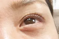 平日11：００限定[次世代まつげパーマ]似合わせラッシュリフト☆トリートメントつき