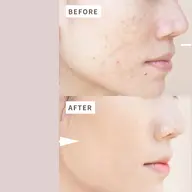 シワたるみ改善！　小顔フェイシャル