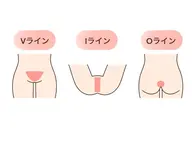 【レディース】ワックス脱毛VIO/デザイン可能！毛量により割引き制度あり◎イベント前の特別価格☆