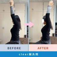 🦴姿勢矯正〜姿勢不良に終止符を〜