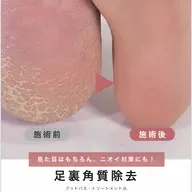 【🛁フット角質ケア】足裏 角質ケア（フットバス＆保湿付✨)
