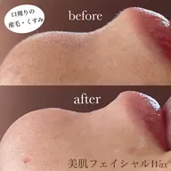 【1日1名様限定❣️】くすみのないツルツル陶器肌に💎「美肌フェイシャルWax＋高保湿パック」ホームケア2日分付き♡