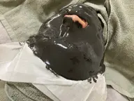 男性フェイシャル脱毛カスマラパック込