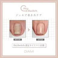 巻き爪ケア2本【Hey Switch】