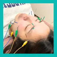 【エラ・食いしばり改善に特化】電気美容鍼＋リンパマッサージ