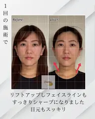 モニター募集!写真掲載可能な方2,000円