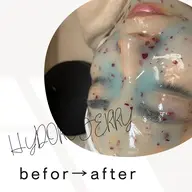 ハイドロジェリーマスク