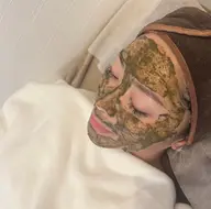 【剥離ありハーブピーリング】繰り返すニキビやニキビ跡・開き毛穴・シミ・シワ・くすみなどを最短改善✨