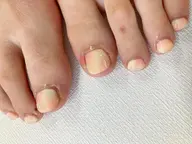 フットネイルやり放題(オフ有)