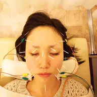 ✨小顔美容鍼(首・あご・顔・頭)🚩75分9900円→6600円