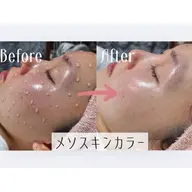 メソスキンカラー ティントファンデーション ファンデーションアートメイク