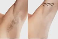 【男性限定】最先端脱毛機械！剛毛脇毛×ふくらはぎ脱毛×腕脱毛　気になる部位3部位まとめてケア