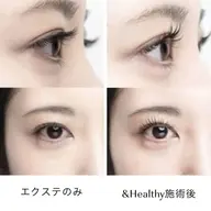 &healthy✖️メガマットボリューム160本