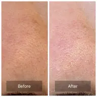 ほてり・敏感ケア🍁【通常8,900円】約90分