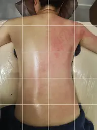 【背中痩せ🔥】鬼痩せマシンで筋膜ケア✨ラジオ波×吸引60分 ¥6600