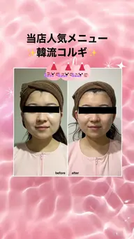 カイロとエステをかけ合わせたお悩みを根本から治していく当店オリジナル人気No.1★コルギです！定価¥17600円