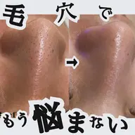 毛穴吸引💆‍♀️✨お試しコース