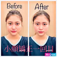 初回限定！【頭の位置を整え○○GET！】小顔矯正 60分