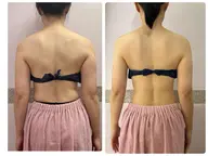 【おすすめ◎痩身・肩こり】筋膜リリース＆ラジオ 波 50分