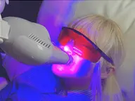 【ミニモ学割】セルフホワイトニング(10分照射✕2回) 1970円