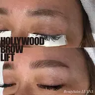 今話題のハリウッドブロウリフト