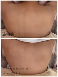 【ご褒美に🎖️背中から顔までたっぷり80分！】背中、肩甲骨周りのオールハンドマッサージ＋フェイシャルエステ