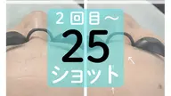 【初回価格】シワ・シミ・くすみなどお顔の部分ケアに 25ショット