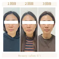 【３回コース】頭蓋骨小顔セラピア