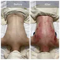 【肩こり/慢性疲労/背中のコリ/むくみ】ガチガチ背中カッサ+背中コルギ40分