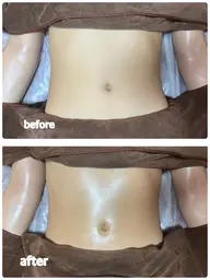 塩もみデトックス腸マッサージ60分