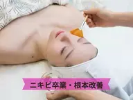 人気No.1【スノーピール】自分史上いちばん白い肌に！光に透けるような肌へ¥8500→¥7000