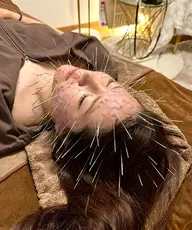 600本ルート鬼美容鍼👹✨一時的な効果じゃない❣️頭蓋骨から小さくなります💀✨整形よりも圧倒的な結果を出します❣️