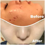 肌質改善 併用で半額