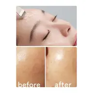 【毛穴撲滅メニュー】ピーリング&毛穴洗浄✨究極の毛穴ケア✨毛穴キュッ、透明感☆毛穴の奥の汚れまで掻き出してむき卵肌に🥚