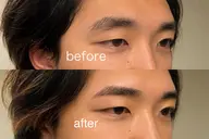 眉毛Wax脱毛 ハリウッドブロウリフト