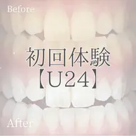 【ミニモ学割ホワイトニング🦷✨】おためし¥2,300✨2回目以降もコスパがいいからホワイトニング始めやすいです😊