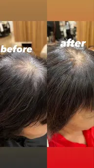 ダメージレスな白髪染め🥣⭐️（リタッチ）