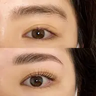 アイブロウリフト