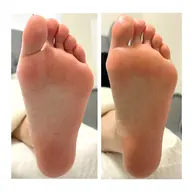 ［フットケア］ベーシックコース