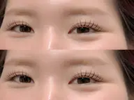 LED フラットラッシュ 100本