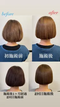 酸熱トリートメント