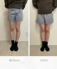 【Google 口コミ投稿♡限定価格０円】O脚矯正30分 通常8,800円→0円