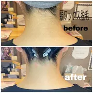 ⭐︎初回⭐︎頸(うなじ)3000円 Wax脱毛(ハードWax使用)