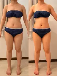 ⭐️速攻痩せダイエット痩身❤️‍🔥キャビゼロ90分