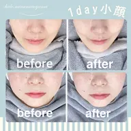 【６０分】痛くない1day小顔選べるフェイシャル【ミニモ限定】