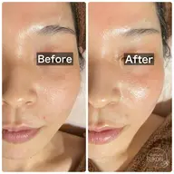 夏専用シーズナルエステ(デコルテ＋フェイシャルのオールハンド)小顔＋透明感＋美白！！(90分)