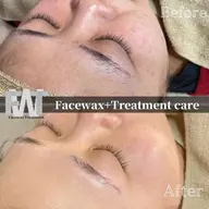 【フェイスワックス】シートパック付