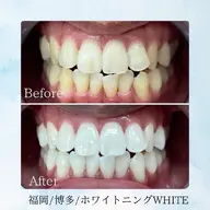 通い放題＆回数券購入済みのお客様はこちらから✨